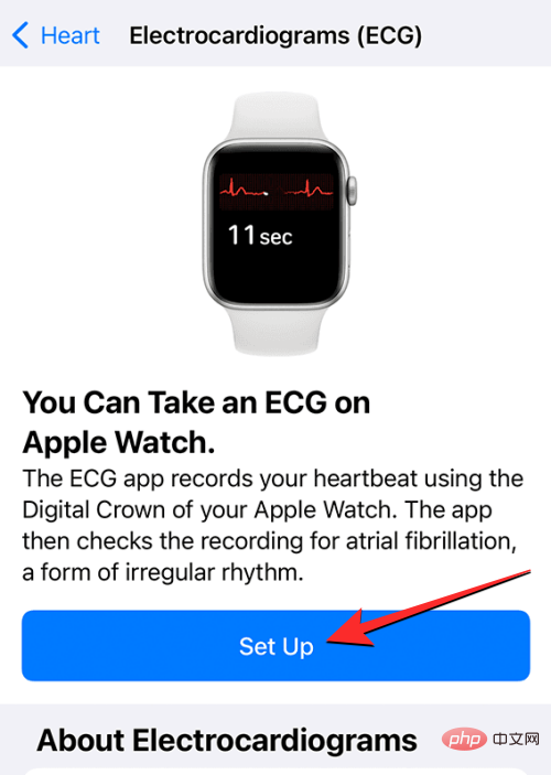 Aufzeichnen eines EKGs auf der Apple Watch: Eine Schritt-für-Schritt-Anleitung