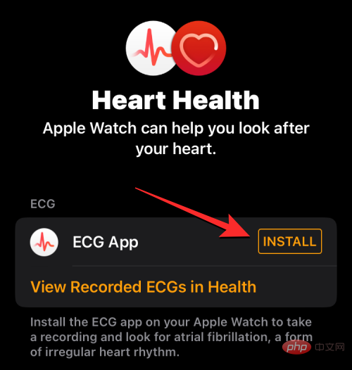 Aufzeichnen eines EKGs auf der Apple Watch: Eine Schritt-für-Schritt-Anleitung