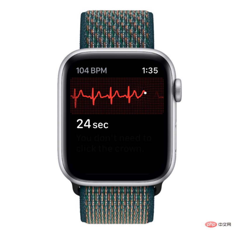 Aufzeichnen eines EKGs auf der Apple Watch: Eine Schritt-für-Schritt-Anleitung