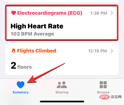 Aufzeichnen eines EKGs auf der Apple Watch: Eine Schritt-für-Schritt-Anleitung