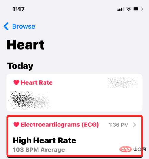 Apple Watch에서 ECG 기록: 단계별 가이드