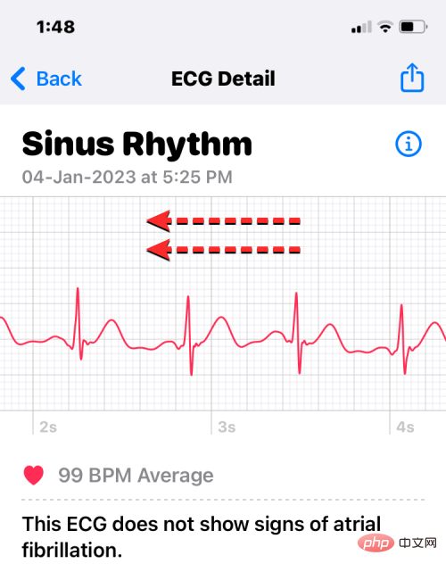 Aufzeichnen eines EKGs auf der Apple Watch: Eine Schritt-für-Schritt-Anleitung