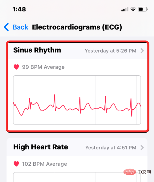 Aufzeichnen eines EKGs auf der Apple Watch: Eine Schritt-für-Schritt-Anleitung