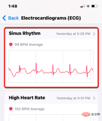 Record an ECG on Apple Watch: A step-by-step guide