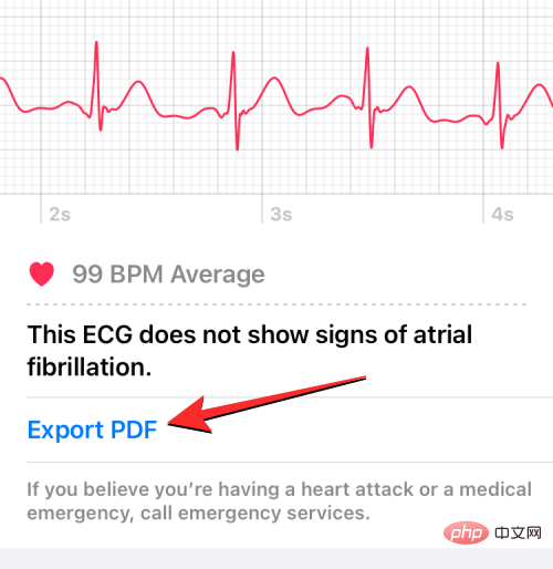 Aufzeichnen eines EKGs auf der Apple Watch: Eine Schritt-für-Schritt-Anleitung