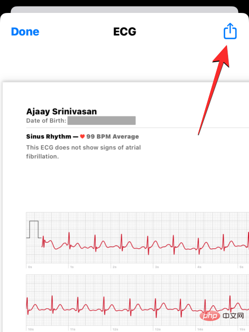 Aufzeichnen eines EKGs auf der Apple Watch: Eine Schritt-für-Schritt-Anleitung