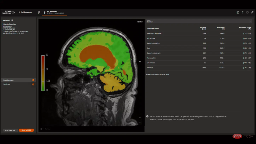 Hintons prediction is coming true! Nature, a top university in the United States and Canada, published an article: General medical artificial intelligence GMAI will not only replace radiologists