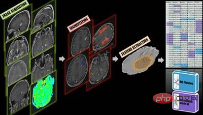 Hintons Vorhersage wird wahr! Nature, eine Spitzenuniversität in den USA und Kanada, hat einen Artikel veröffentlicht: Allgemeine medizinische künstliche Intelligenz GMAI wird nicht nur „Radiologen“ ersetzen.