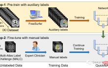 医学图像的深度学习的完整代码示例：使用Pytorch对MRI脑扫描的图像进行分割