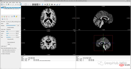 Full code example of deep learning for medical images: Segmenting images from MRI brain scans using Pytorch