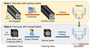 Full code example of deep learning for medical images: Segmenting images from MRI brain scans using Pytorch