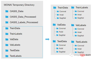 Full code example of deep learning for medical images: Segmenting images from MRI brain scans using Pytorch