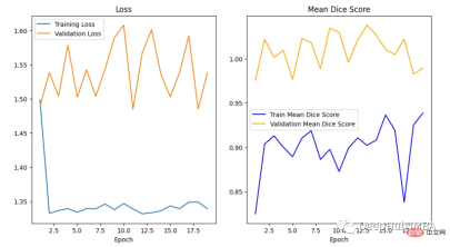 Full code example of deep learning for medical images: Segmenting images from MRI brain scans using Pytorch