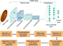 Data-driven diagnosis using deep learning methods in glaucoma detection