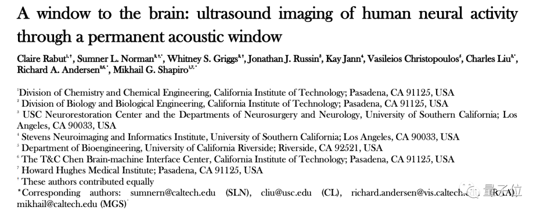 Genauer und minimal-invasiver als Musks Gehirn-Computer-Schnittstelle ist die Ultraschall-Gehirnlesemethode da