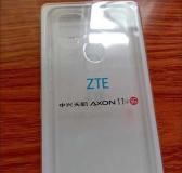 中兴天机Axon11SE评测（一款高性价比的智能手机，引领科技潮流）