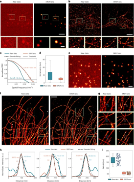 To remove noise in fluorescence images in a self-supervised manner, the Tsinghua team developed the spatial redundancy denoising Transformer method