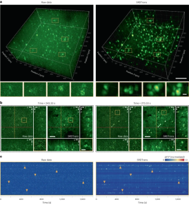 To remove noise in fluorescence images in a self-supervised manner, the Tsinghua team developed the spatial redundancy denoising Transformer method