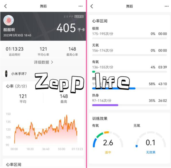 Was ist der Unterschied zwischen Xiaomi Sports Health und zepplife?