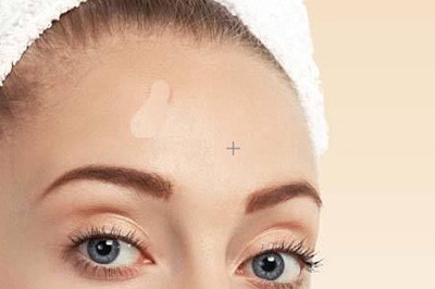 How to use Photoshop to remove acne