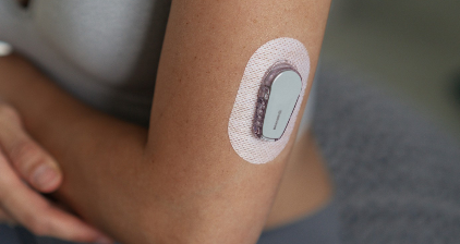 Großbritannien wird Zehntausenden Diabetikern eine „künstliche Bauchspeicheldrüse“ implantieren