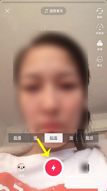 How to open Stories on Douyin_Step-by-step tutorial on opening Stories on Douyin