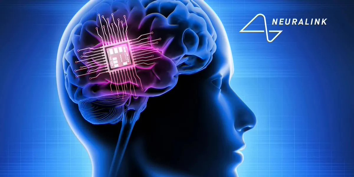 马斯克脑机接口公司 Neuralink 启动植入物研究,计划招募三名患者