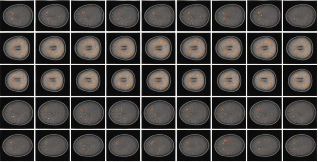 L'équipe ECCV2024 | Harvard développe FairDomain pour parvenir à l'équité dans la segmentation et la classification des images médicales inter-domaines