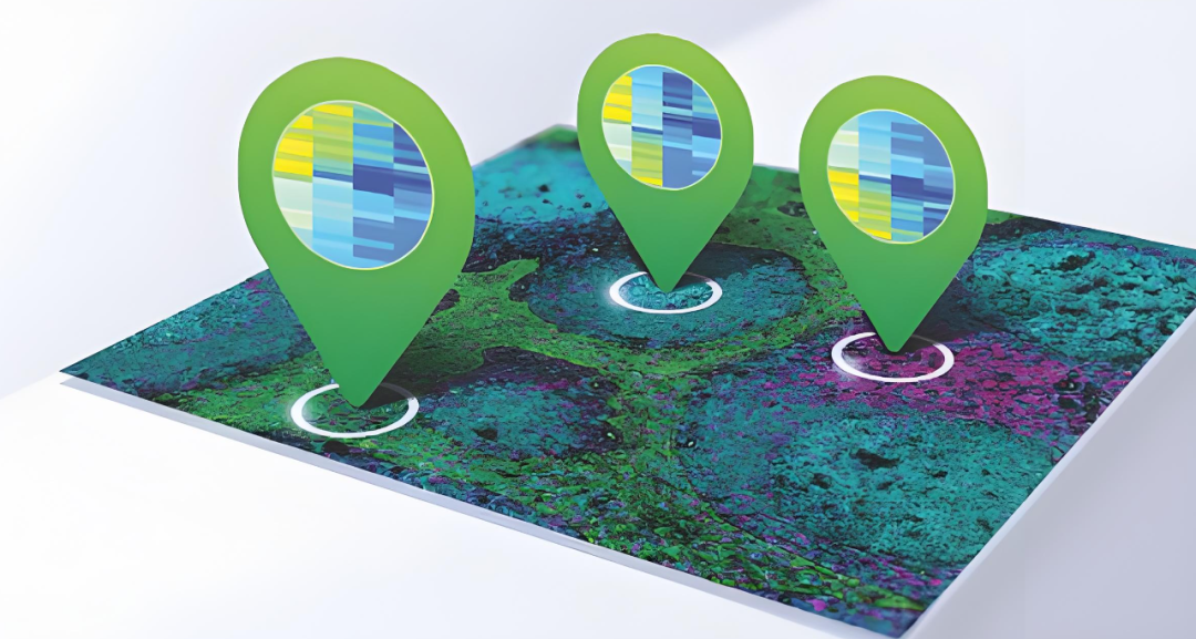 36 times higher than the original resolution, teams from Beihang University and Tsinghua University used AI to characterize tissues at high resolution on a multi-space omics platform, published in the Nature sub-journal