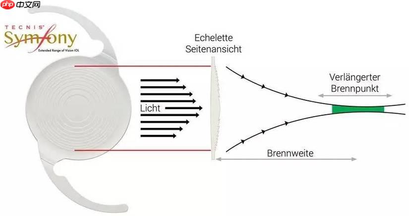 Symfony 怎样把事件对象转为数组