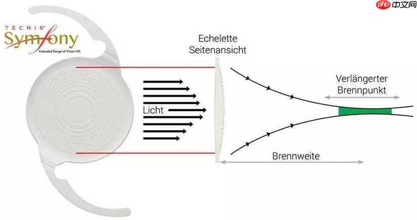 Symfony 怎样将SOAP请求转为数组