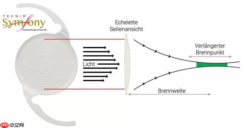 symfony 怎样把json字符串转为对象