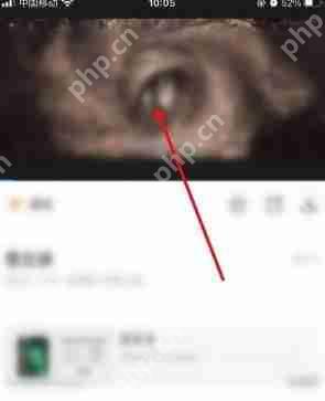影视大全怎么投屏到电视上
