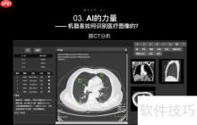 智能医疗影像系统方案开发：推动医疗行业新变革