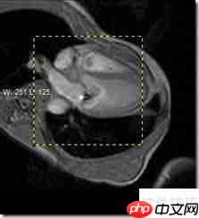 LEADTOOLS医学影像浏览器入门指南