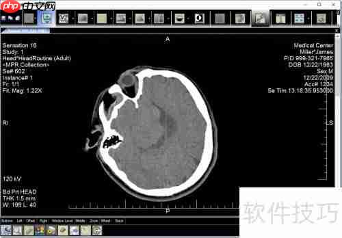 LEADTOOLS医学影像工作站使用入门指南