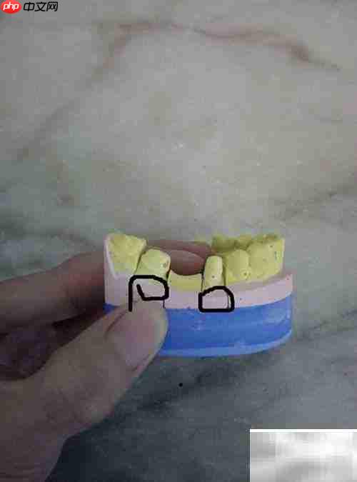 固定义齿与活动义齿对比