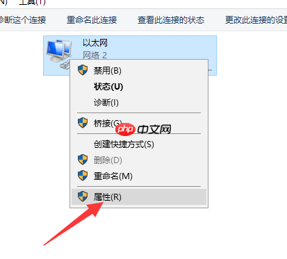 Win10以太网络电缆被拔出怎么解决？