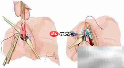 医疗机构手术分级管理