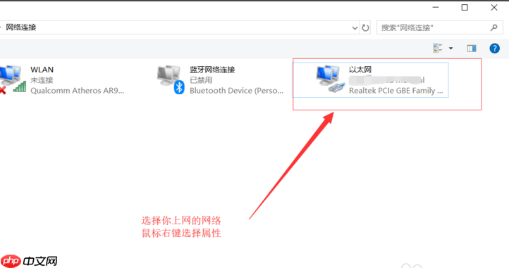 win10网络感叹号连不上网怎么解决