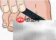 正甲贴:甲沟炎治疗新选择