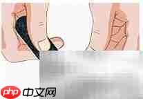 正甲贴:甲沟炎治疗新选择