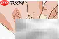 正甲贴:甲沟炎治疗新选择