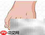 正甲贴:甲沟炎治疗新选择