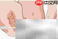 正甲贴:甲沟炎治疗新选择