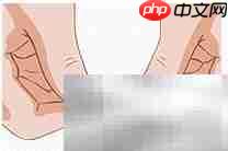 正甲贴:甲沟炎治疗新选择