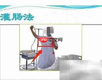 0.1%-0.2%灌肠液配制方法