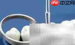 牙科常见修复方式一览