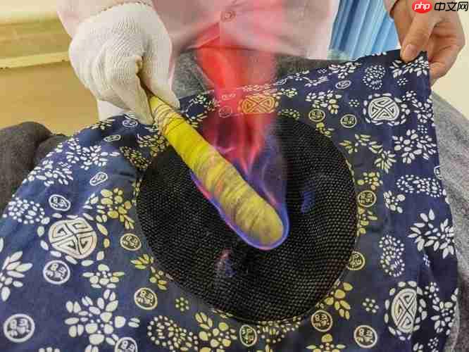 让头顶冒火的针灸形容的是以下哪种传统治疗手段