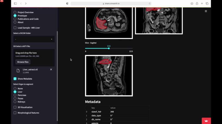 AI驱动的医学影像器官分割与3D可视化：临床应用的未来